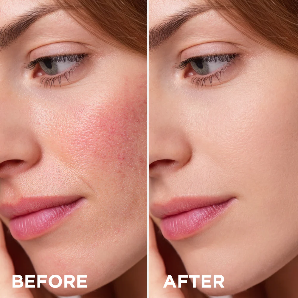 Beautifying moisturizing cream neutralizes redness - Image 5