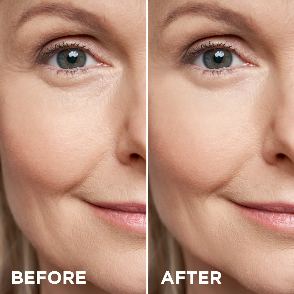 Gold cream + lifting essence for the eyes and eyelids - Image 3